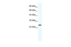 CACNG6 Rabbit anti-Human, Polyclonal, Novus Biologicals 0.1ml; Unconjugated:Antibodies,